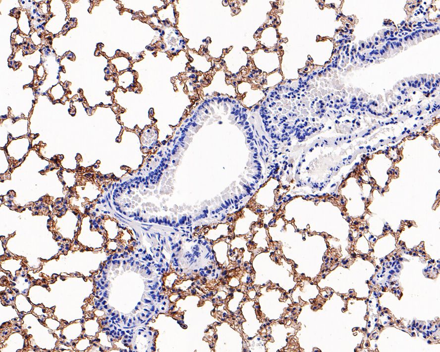 Immunohistochemical analysis of paraffin-embedded mouse lung tissue with Rabbit anti-RAGE antibody (ET1702-27) at 1/1,000 dilution.<br />
<br />
The section was pre-treated using heat mediated antigen retrieval with Tris-EDTA buffer (pH 9.0) for 20 minutes. The tissues were blocked in 1% BSA for 20 minutes at room temperature, washed with ddH2O and PBS, and then probed with the primary antibody (ET1702-27) at 1/1,000 dilution for 1 hour at room temperature. The detection was performed using an HRP conjugated compact polymer system. DAB was used as the chromogen. Tissues were counterstained with hematoxylin and mounted with DPX.