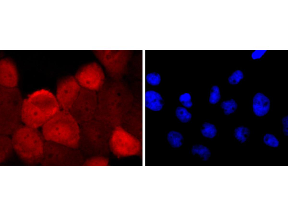 ICC staining of S100 alpha 6 in A431 cells (red). Formalin fixed cells were permeabilized with 0.1% Triton X-100 in TBS for 10 minutes at room temperature and blocked with 1% Blocker BSA for 15 minutes at room temperature. Cells were probed with the primary antibody (ET1702-28, 1/50) for 1 hour at room temperature, washed with PBS. Alexa Fluor®594 Goat anti-Rabbit IgG was used as the secondary antibody at 1/1,000 dilution. The nuclear counter stain is DAPI (blue).
