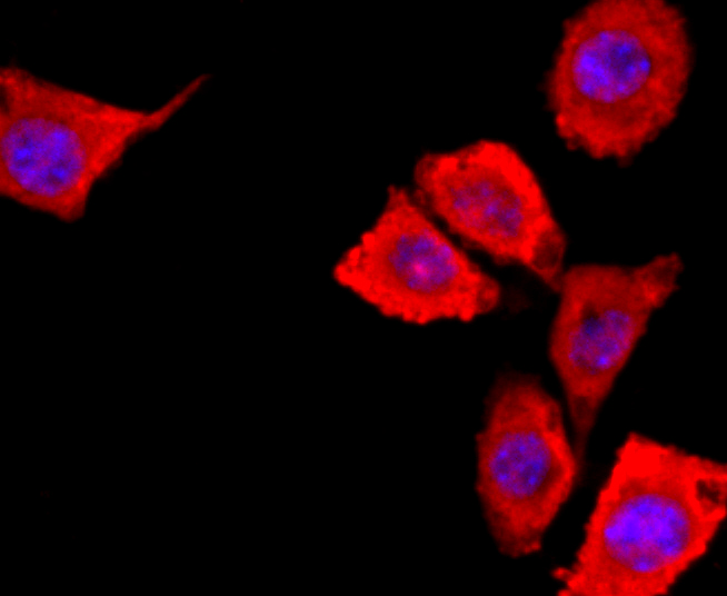 ICC staining of S100 alpha 6 in SH-SY5Y cells (red). Formalin fixed cells were permeabilized with 0.1% Triton X-100 in TBS for 10 minutes at room temperature and blocked with 1% Blocker BSA for 15 minutes at room temperature. Cells were probed with the primary antibody (ET1702-28, 1/50) for 1 hour at room temperature, washed with PBS. Alexa Fluor®594 Goat anti-Rabbit IgG was used as the secondary antibody at 1/1,000 dilution. The nuclear counter stain is DAPI (blue).
