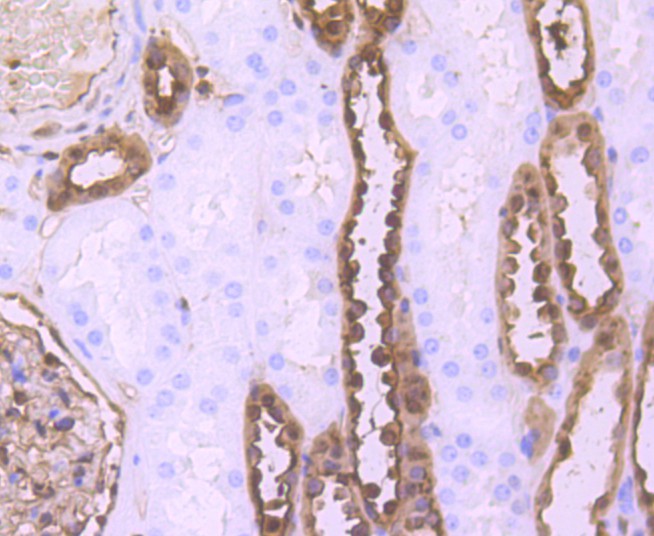 Immunohistochemical analysis of paraffin-embedded human kidney tissue using anti-S100 alpha 6 antibody. The section was pre-treated using heat mediated antigen retrieval with Tris-EDTA buffer (pH 8.0-8.4) for 20 minutes.The tissues were blocked in 5% BSA for 30 minutes at room temperature, washed with ddH2O and PBS, and then probed with the primary antibody (ET1702-28, 1/50) for 30 minutes at room temperature. The detection was performed using an HRP conjugated compact polymer system. DAB was used as the chromogen. Tissues were counterstained with hematoxylin and mounted with DPX.
