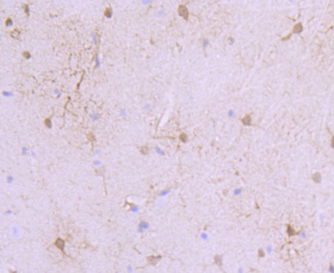 Immunohistochemical analysis of paraffin-embedded mouse brain tissue using anti-S100 alpha 6 antibody. The section was pre-treated using heat mediated antigen retrieval with Tris-EDTA buffer (pH 8.0-8.4) for 20 minutes.The tissues were blocked in 5% BSA for 30 minutes at room temperature, washed with ddH2O and PBS, and then probed with the primary antibody (ET1702-28, 1/50) for 30 minutes at room temperature. The detection was performed using an HRP conjugated compact polymer system. DAB was used as the chromogen. Tissues were counterstained with hematoxylin and mounted with DPX.
