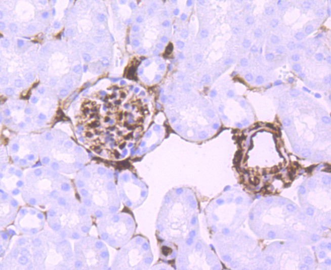 Immunohistochemical analysis of paraffin-embedded mouse kidney tissue using anti-S100 alpha 6 antibody. The section was pre-treated using heat mediated antigen retrieval with Tris-EDTA buffer (pH 8.0-8.4) for 20 minutes.The tissues were blocked in 5% BSA for 30 minutes at room temperature, washed with ddH2O and PBS, and then probed with the primary antibody (ET1702-28, 1/50) for 30 minutes at room temperature. The detection was performed using an HRP conjugated compact polymer system. DAB was used as the chromogen. Tissues were counterstained with hematoxylin and mounted with DPX.