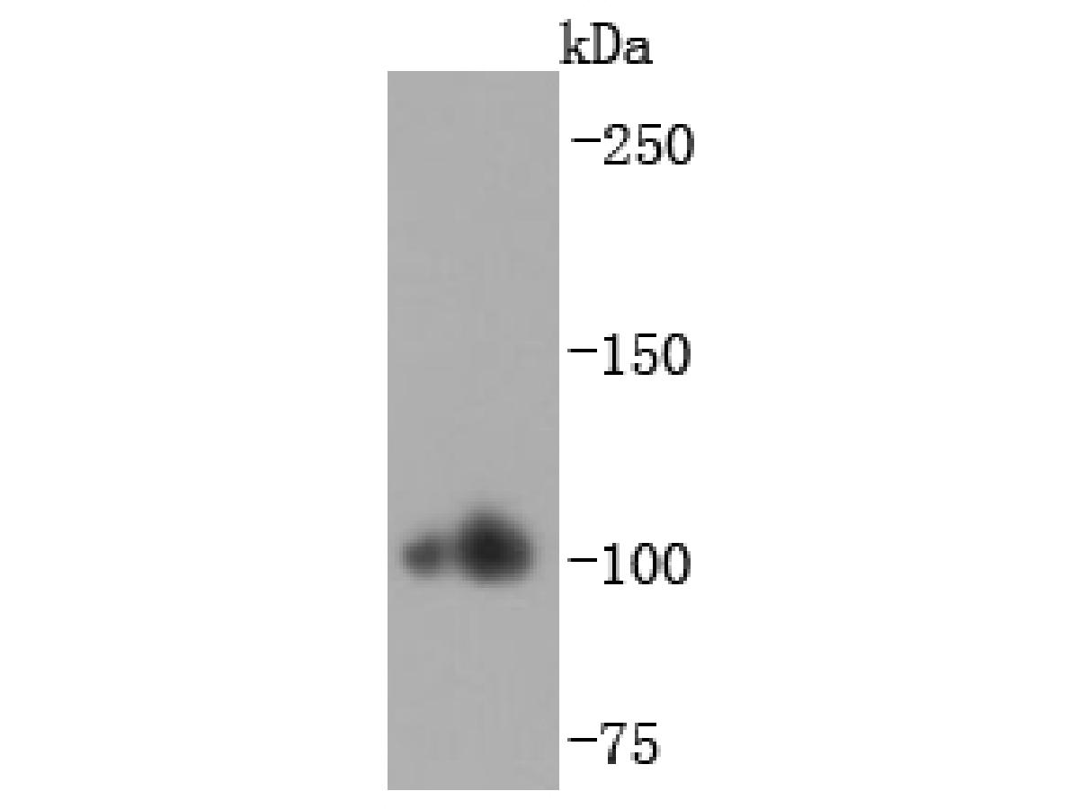Western blot analysis of Alpha Actinin 2 on human heart tissue lysates. Proteins were transferred to a PVDF membrane and blocked with 5% BSA in PBS for 1 hour at room temperature. The primary antibody (ET1702-30, 1/500) was used in 5% BSA at room temperature for 2 hours. Goat Anti-Rabbit IgG - HRP Secondary Antibody (HA1001) at 1:200,000 dilution was used for 1 hour at room temperature.
