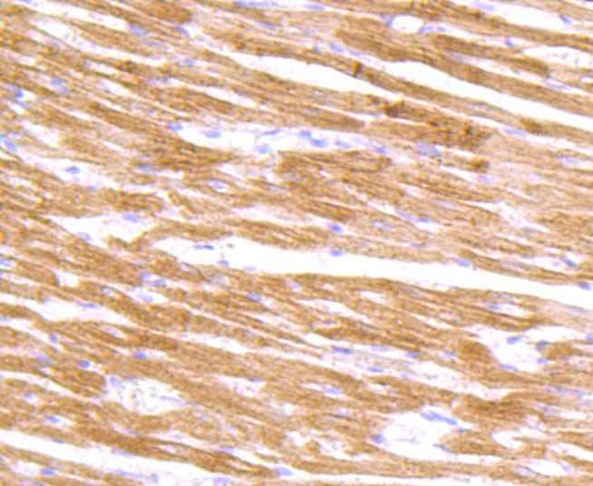 Immunohistochemical analysis of paraffin-embedded rat heart tissue using anti-Alpha Actinin 2 antibody. The section was pre-treated using heat mediated antigen retrieval with Tris-EDTA buffer (pH 9.0) for 20 minutes.The tissues were blocked in 1% BSA for 30 minutes at room temperature, washed with ddH2O and PBS, and then probed with the primary antibody (ET1702-30, 1/50) for 30 minutes at room temperature. The detection was performed using an HRP conjugated compact polymer system. DAB was used as the chromogen. Tissues were counterstained with hematoxylin and mounted with DPX.