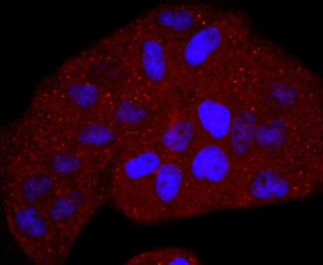 ICC staining of Thymidine Kinase 1 in Hela cells (red). Formalin fixed cells were permeabilized with 0.1% Triton X-100 in TBS for 10 minutes at room temperature and blocked with 10% negative goat serum for 15 minutes at room temperature. Cells were probed with the primary antibody (ET1702-31, 1/50) for 1 hour at room temperature, washed with PBS. Alexa Fluor®594 conjugate-Goat anti-Rabbit IgG was used as the secondary antibody at 1/1,000 dilution. The nuclear counter stain is DAPI (blue).