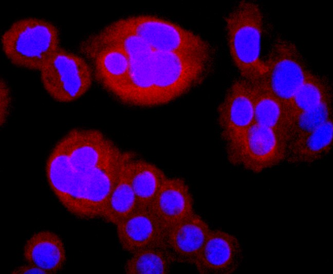ICC staining of Thymidine Kinase 1 in SW480 cells (red). Formalin fixed cells were permeabilized with 0.1% Triton X-100 in TBS for 10 minutes at room temperature and blocked with 10% negative goat serum for 15 minutes at room temperature. Cells were probed with the primary antibody (ET1702-31, 1/50) for 1 hour at room temperature, washed with PBS. Alexa Fluor®594 conjugate-Goat anti-Rabbit IgG was used as the secondary antibody at 1/1,000 dilution. The nuclear counter stain is DAPI (blue).