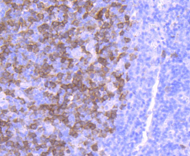 Immunohistochemical analysis of paraffin-embedded human tonsil tissue using anti-Thymidine Kinase 1 antibody. The section was pre-treated using heat mediated antigen retrieval with Tris-EDTA buffer (pH 9.0) for 20 minutes.The tissues were blocked in 1% BSA for 30 minutes at room temperature, washed with ddH2O and PBS, and then probed with the primary antibody (ET1702-31, 1/50) for 30 minutes at room temperature. The detection was performed using an HRP conjugated compact polymer system. DAB was used as the chromogen. Tissues were counterstained with hematoxylin and mounted with DPX.