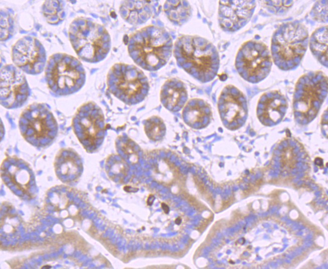 Immunohistochemical analysis of paraffin-embedded mouse colon tissue using anti-gamma Tubulin antibody. The section was pre-treated using heat mediated antigen retrieval with Tris-EDTA buffer (pH 8.0-8.4) for 20 minutes.The tissues were blocked in 5% BSA for 30 minutes at room temperature, washed with ddH2O and PBS, and then probed with the primary antibody (ET1702-32, 1/50) for 30 minutes at room temperature. The detection was performed using an HRP conjugated compact polymer system. DAB was used as the chromogen. Tissues were counterstained with hematoxylin and mounted with DPX.