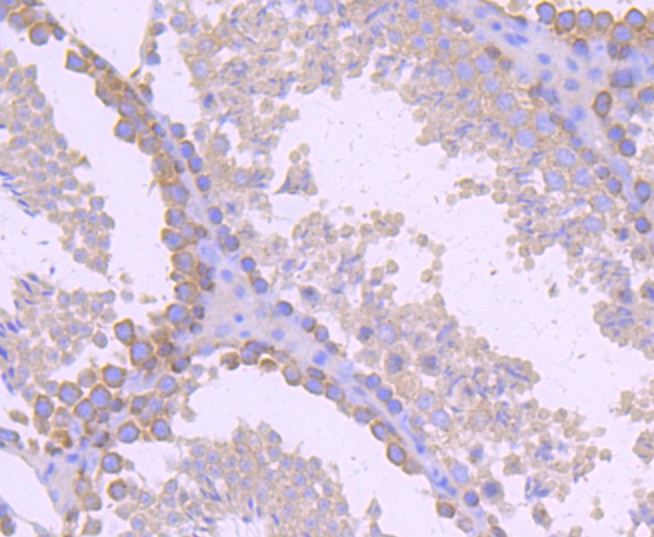 Immunohistochemical analysis of paraffin-embedded mouse testis tissue using anti-gamma Tubulin antibody. The section was pre-treated using heat mediated antigen retrieval with Tris-EDTA buffer (pH 8.0-8.4) for 20 minutes.The tissues were blocked in 5% BSA for 30 minutes at room temperature, washed with ddH2O and PBS, and then probed with the primary antibody (ET1702-32, 1/50) for 30 minutes at room temperature. The detection was performed using an HRP conjugated compact polymer system. DAB was used as the chromogen. Tissues were counterstained with hematoxylin and mounted with DPX.