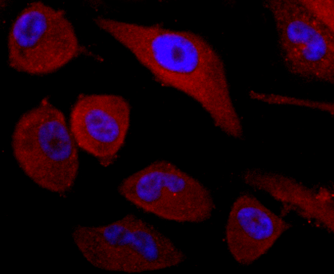 ICC staining of CD99 in PC-3M cells (red). Formalin fixed cells were permeabilized with 0.1% Triton X-100 in TBS for 10 minutes at room temperature and blocked with 1% Blocker BSA for 15 minutes at room temperature. Cells were probed with the primary antibody (ET1702-35, 1/50) for 1 hour at room temperature, washed with PBS. Alexa Fluor®594 Goat anti-Rabbit IgG was used as the secondary antibody at 1/1,000 dilution. The nuclear counter stain is DAPI (blue).