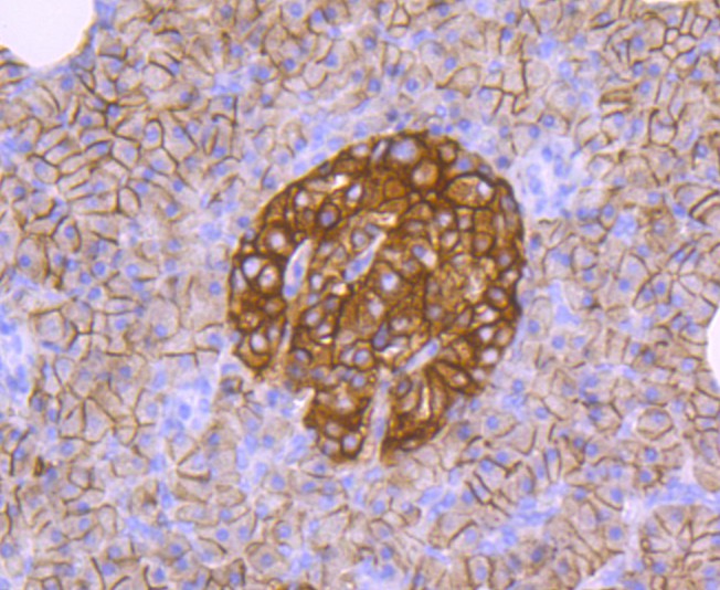 Immunohistochemical analysis of paraffin-embedded human pancreas tissue using anti-CD99 antibody. The section was pre-treated using heat mediated antigen retrieval with Tris-EDTA buffer (pH 9.0) for 20 minutes.The tissues were blocked in 5% BSA for 30 minutes at room temperature, washed with ddH2O and PBS, and then probed with the primary antibody (ET1702-35, 1/50) for 30 minutes at room temperature. The detection was performed using an HRP conjugated compact polymer system. DAB was used as the chromogen. Tissues were counterstained with hematoxylin and mounted with DPX.