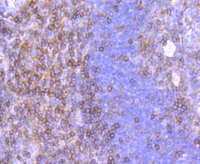 Immunohistochemical analysis of paraffin-embedded human tonsil tissue using anti-CD99 antibody. The section was pre-treated using heat mediated antigen retrieval with Tris-EDTA buffer (pH 9.0) for 20 minutes.The tissues were blocked in 5% BSA for 30 minutes at room temperature, washed with ddH2O and PBS, and then probed with the primary antibody (ET1702-35, 1/50) for 30 minutes at room temperature. The detection was performed using an HRP conjugated compact polymer system. DAB was used as the chromogen. Tissues were counterstained with hematoxylin and mounted with DPX.