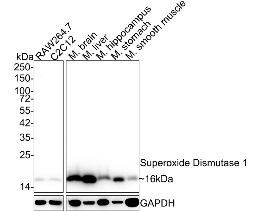 Western blot analysis of Superoxide Dismutase 1 on different lysates with Rabbit anti-Superoxide Dismutase 1 antibody (ET1702-36) at 1/500 dilution.<br />
<br />
Lane 1: MCF-7 cell lysate<br />
Lane 2: HepG2 cell lysate<br />
Lane 3: SH-SY5Y cell lysate<br />
<br />
Lysates/proteins at 10 µg/Lane.<br />
<br />
Predicted band size: 16 kDa<br />
Observed band size: 16 kDa<br />
<br />
Exposure time: 2 minutes;<br />
<br />
15% SDS-PAGE gel.<br />
<br />
Proteins were transferred to a PVDF membrane and blocked with 5% NFDM/TBST for 1 hour at room temperature. The primary antibody (ET1702-36) at 1/500 dilution was used in 5% NFDM/TBST at room temperature for 2 hours. Goat Anti-Rabbit IgG - HRP Secondary Antibody (HA1001) at 1:300,000 dilution was used for 1 hour at room temperature.