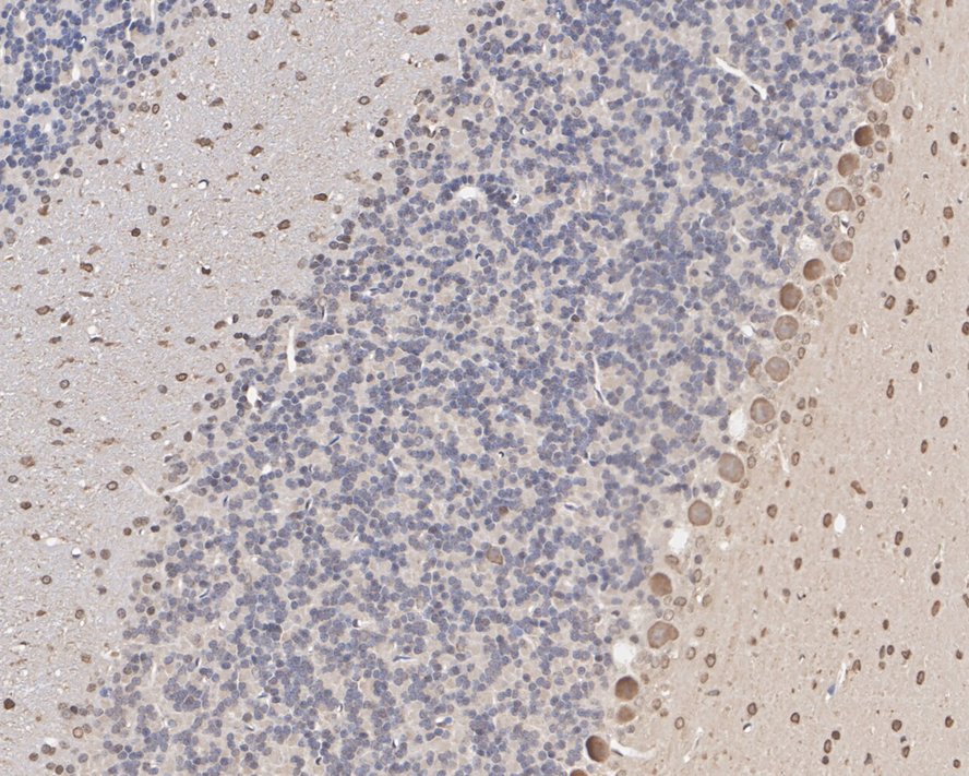 Immunohistochemical analysis of paraffin-embedded rat brain tissue using anti-SOD1 antibody. Counter stained with hematoxylin.