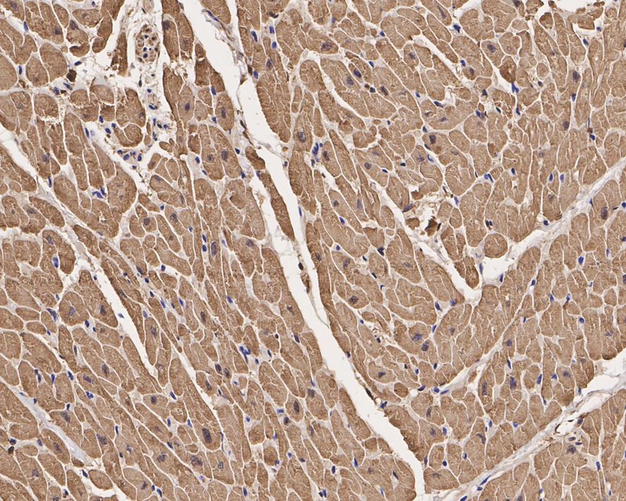 Immunohistochemical analysis of paraffin-embedded human heart tissue with Rabbit anti-Cardiac Troponin I antibody (ET1702-37) at 1/1,000 dilution.<br />
<br />
The section was pre-treated using heat mediated antigen retrieval with Tris-EDTA buffer (pH 9.0) for 20 minutes. The tissues were blocked in 1% BSA for 20 minutes at room temperature, washed with ddH2O and PBS, and then probed with the primary antibody (ET1702-37) at 1/1,000 dilution for 1 hour at room temperature. The detection was performed using an HRP conjugated compact polymer system. DAB was used as the chromogen. Tissues were counterstained with hematoxylin and mounted with DPX.