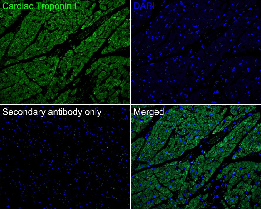 Immunofluorescence analysis of paraffin-embedded human heart tissue labeling Cardiac Troponin I with Rabbit anti-Cardiac Troponin I antibody (ET1702-37) at 1/200 dilution.<br />
<br />
The section was pre-treated using heat mediated antigen retrieval with Tris-EDTA buffer (pH 9.0) for 20 minutes. The tissues were blocked in 10% negative goat serum for 1 hour at room temperature, washed with PBS, and then probed with the primary antibody (ET1702-37, green) at 1/200 dilution overnight at 4 ℃, washed with PBS. Goat Anti-Rabbit IgG H&L (iFluor™ 488, HA1121) was used as the secondary antibody at 1/1,000 dilution. Nuclei were counterstained with DAPI (blue).