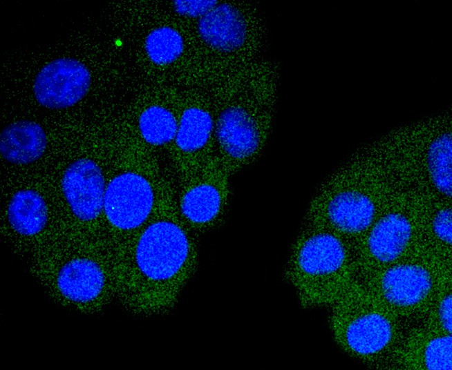 ICC staining of Cardiac Troponin I in HepG2 cells (green). Formalin fixed cells were permeabilized with 0.1% Triton X-100 in TBS for 10 minutes at room temperature and blocked with 10% negative goat serum for 15 minutes at room temperature. Cells were probed with the primary antibody (ET1702-37, 1/50) for 1 hour at room temperature, washed with PBS. Alexa Fluor®488 conjugate-Goat anti-Rabbit IgG was used as the secondary antibody at 1/1,000 dilution. The nuclear counter stain is DAPI (blue).