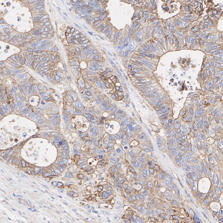 Immunohistochemical analysis of paraffin-embedded human kidney tissue using anti-S100A10 antibody. The section was pre-treated using heat mediated antigen retrieval with Tris-EDTA buffer (pH 8.0-8.4) for 20 minutes.The tissues were blocked in 5% BSA for 30 minutes at room temperature, washed with ddH2O and PBS, and then probed with the primary antibody (ET1702-38, 1/50) for 30 minutes at room temperature. The detection was performed using an HRP conjugated compact polymer system. DAB was used as the chromogen. Tissues were counterstained with hematoxylin and mounted with DPX.