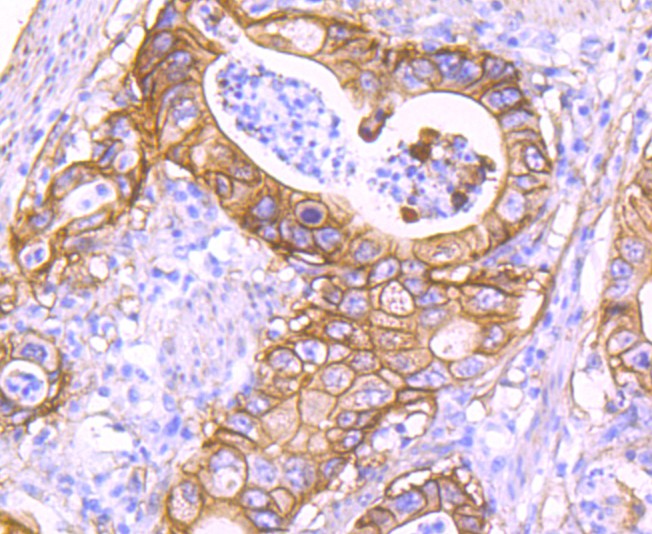 Immunohistochemical analysis of paraffin-embedded mouse kidney tissue using anti-S100A10 antibody. The section was pre-treated using heat mediated antigen retrieval with Tris-EDTA buffer (pH 8.0-8.4) for 20 minutes.The tissues were blocked in 5% BSA for 30 minutes at room temperature, washed with ddH2O and PBS, and then probed with the primary antibody (ET1702-38, 1/50) for 30 minutes at room temperature. The detection was performed using an HRP conjugated compact polymer system. DAB was used as the chromogen. Tissues were counterstained with hematoxylin and mounted with DPX.