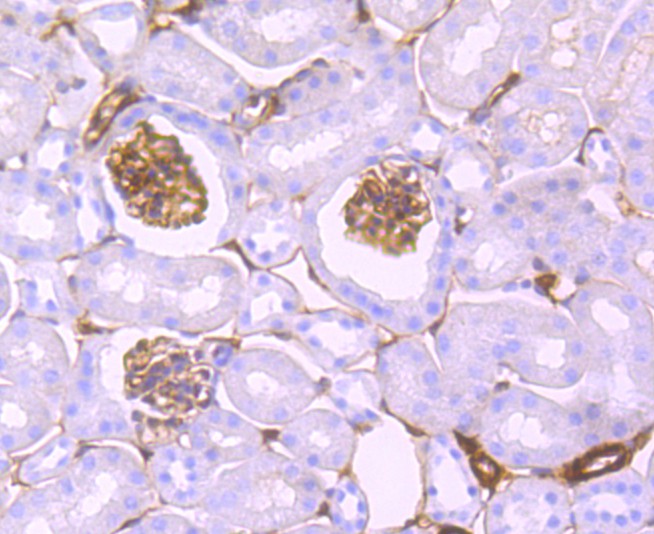 Immunohistochemical analysis of paraffin-embedded mouse colon tissue using anti-S100A10 antibody. The section was pre-treated using heat mediated antigen retrieval with Tris-EDTA buffer (pH 8.0-8.4) for 20 minutes.The tissues were blocked in 5% BSA for 30 minutes at room temperature, washed with ddH2O and PBS, and then probed with the primary antibody (ET1702-38, 1/50) for 30 minutes at room temperature. The detection was performed using an HRP conjugated compact polymer system. DAB was used as the chromogen. Tissues were counterstained with hematoxylin and mounted with DPX.