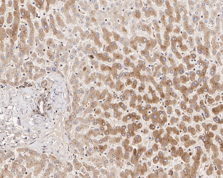Immunohistochemical analysis of paraffin-embedded human kidney tissue with Rabbit anti-Argonaute 2 antibody (ET1702-39) at 1/4,000 dilution.<br />
<br />
The section was pre-treated using heat mediated antigen retrieval with Tris-EDTA buffer (pH 9.0) for 20 minutes. The tissues were blocked in 1% BSA for 20 minutes at room temperature, washed with ddH2O and PBS, and then probed with the primary antibody (ET1702-39) at 1/4,000 dilution for 1 hour at room temperature. The detection was performed using an HRP conjugated compact polymer system. DAB was used as the chromogen. Tissues were counterstained with hematoxylin and mounted with DPX.