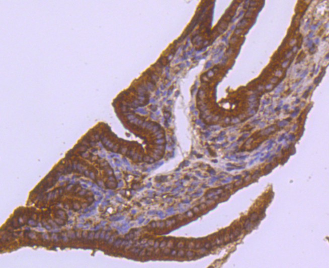 Immunohistochemical analysis of paraffin-embedded mouse placenta tissue using anti-ABCG2 antibody. The section was pre-treated using heat mediated antigen retrieval with Tris-EDTA buffer (pH 8.0-8.4) for 20 minutes.The tissues were blocked in 5% BSA for 30 minutes at room temperature, washed with ddH2O and PBS, and then probed with the primary antibody (ET1702-40, 1/50) for 30 minutes at room temperature. The detection was performed using an HRP conjugated compact polymer system. DAB was used as the chromogen. Tissues were counterstained with hematoxylin and mounted with DPX.