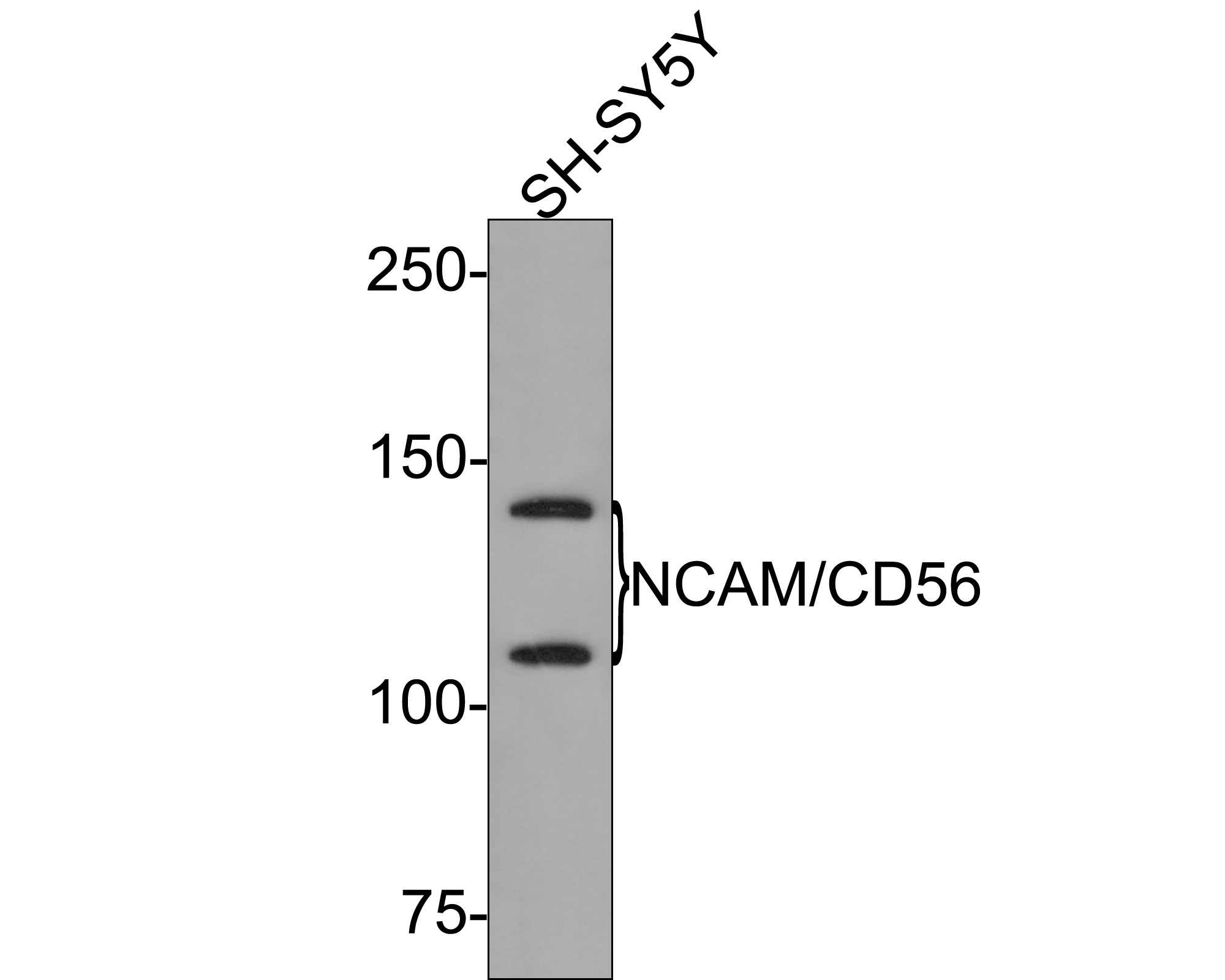 Western blot analysis of NCAM/CD56 on SH-SY5Y cell lysates with Rabbit anti-NCAM/CD56 antibody (ET1702-43) at 1/500 dilution.<br />
<br />
Lysates/proteins at 10 µg/Lane.<br />
<br />
Predicted band size: 95 kDa<br />
Observed band size: 120/140 kDa<br />
<br />
Exposure time: 2 minutes;<br />
<br />
6% SDS-PAGE gel.<br />
<br />
Proteins were transferred to a PVDF membrane and blocked with 5% NFDM/TBST for 1 hour at room temperature. The primary antibody (ET1702-43) at 1/500 dilution was used in 5% NFDM/TBST at room temperature for 2 hours. Goat Anti-Rabbit IgG - HRP Secondary Antibody (HA1001) at 1:300,000 dilution was used for 1 hour at room temperature.