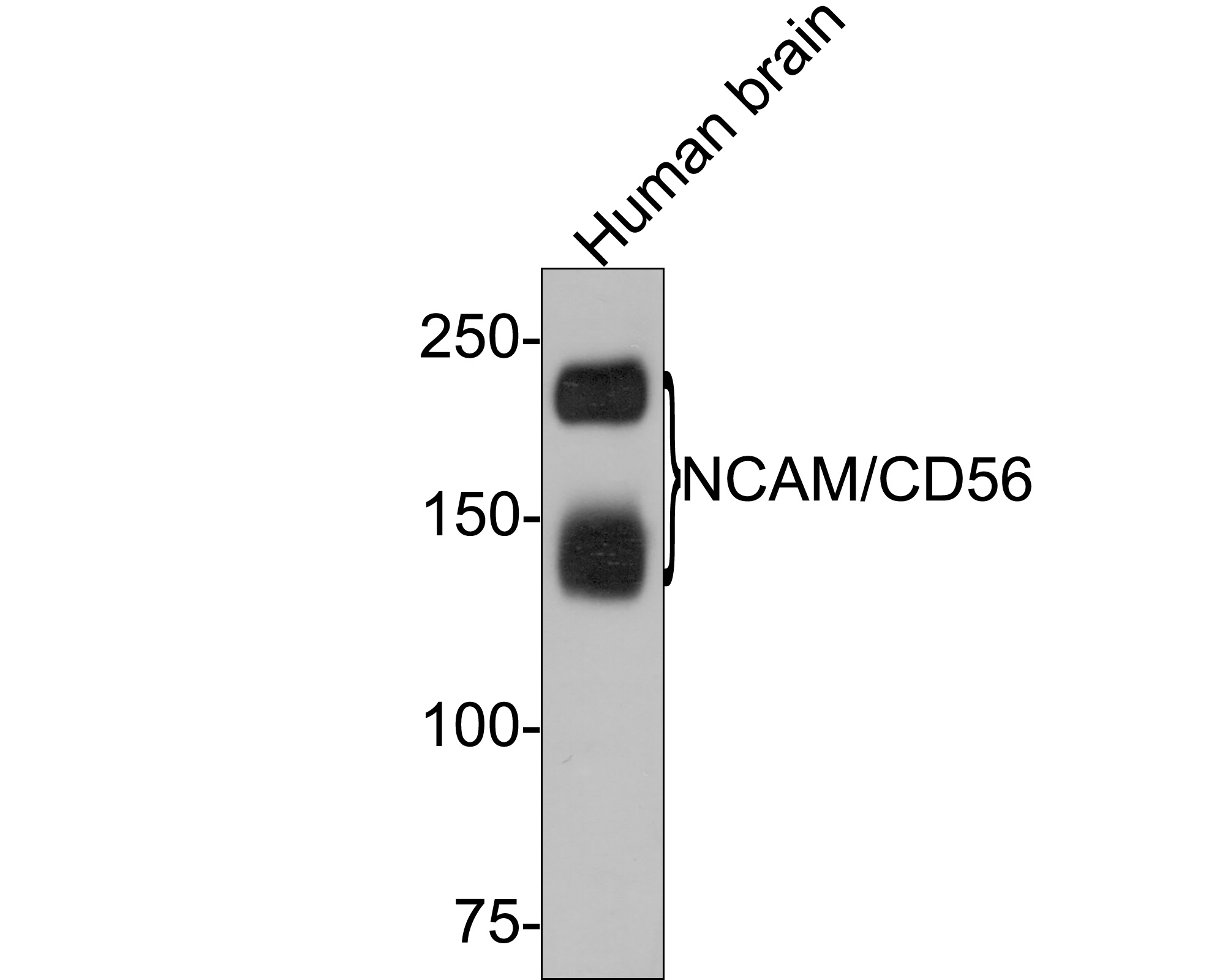 Western blot analysis of NCAM/CD56 on human brain tissue lysates with Rabbit anti-NCAM/CD56 antibody (ET1702-43) at 1/2,000 dilution.<br />
<br />
Lysates/proteins at 20 µg/Lane.<br />
<br />
Predicted band size: 95 kDa<br />
Observed band size: 140/180 kDa<br />
<br />
Exposure time: 30 seconds;<br />
<br />
6% SDS-PAGE gel.<br />
<br />
Proteins were transferred to a PVDF membrane and blocked with 5% NFDM/TBST for 1 hour at room temperature. The primary antibody (ET1702-43) at 1/2,000 dilution was used in 5% NFDM/TBST at room temperature for 2 hours. Goat Anti-Rabbit IgG - HRP Secondary Antibody (HA1001) at 1:300,000 dilution was used for 1 hour at room temperature.