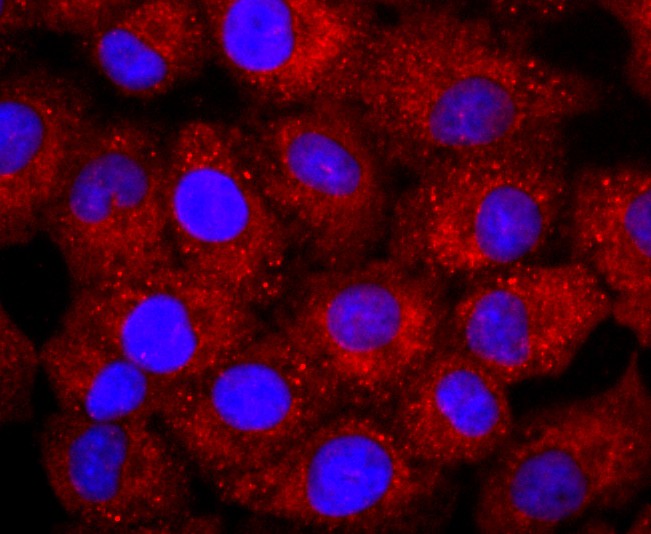 ICC staining of NCAM/CD56 in A549 cells (red). Formalin fixed cells were permeabilized with 0.1% Triton X-100 in TBS for 10 minutes at room temperature and blocked with 1% Blocker BSA for 15 minutes at room temperature. Cells were probed with the primary antibody (ET1702-43, 1/50) for 1 hour at room temperature, washed with PBS. Alexa Fluor®594 Goat anti-Rabbit IgG was used as the secondary antibody at 1/1,000 dilution. The nuclear counter stain is DAPI (blue).