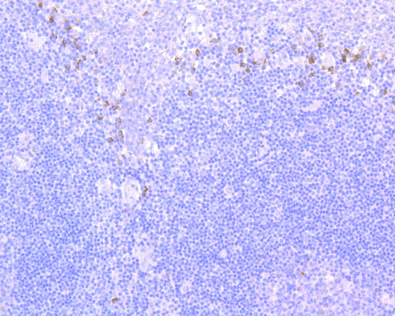 ICC staining of NCAM/CD56 in SH-SY5Y cells (red). Formalin fixed cells were permeabilized with 0.1% Triton X-100 in TBS for 10 minutes at room temperature and blocked with 1% Blocker BSA for 15 minutes at room temperature. Cells were probed with the primary antibody (ET1702-43, 1/50) for 1 hour at room temperature, washed with PBS. Alexa Fluor®594 Goat anti-Rabbit IgG was used as the secondary antibody at 1/1,000 dilution. The nuclear counter stain is DAPI (blue).