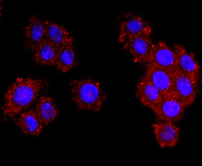 ICC staining of Dysferlin in SW480 cells (red). Formalin fixed cells were permeabilized with 0.1% Triton X-100 in TBS for 10 minutes at room temperature and blocked with 1% Blocker BSA for 15 minutes at room temperature. Cells were probed with the primary antibody (ET1702-45, 1/50) for 1 hour at room temperature, washed with PBS. Alexa Fluor®594 Goat anti-Rabbit IgG was used as the secondary antibody at 1/1,000 dilution. The nuclear counter stain is DAPI (blue).