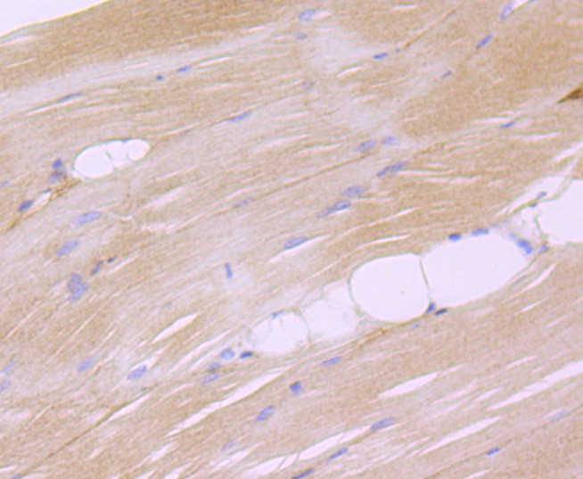 Immunohistochemical analysis of paraffin-embedded mouse skeletal muscle tissue using anti-Dysferlin antibody. The section was pre-treated using heat mediated antigen retrieval with Tris-EDTA buffer (pH 8.0-8.4) for 20 minutes.The tissues were blocked in 5% BSA for 30 minutes at room temperature, washed with ddH2O and PBS, and then probed with the primary antibody (ET1702-45, 1/50) for 30 minutes at room temperature. The detection was performed using an HRP conjugated compact polymer system. DAB was used as the chromogen. Tissues were counterstained with hematoxylin and mounted with DPX.