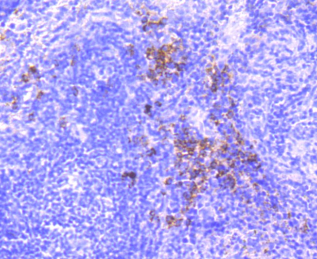 Immunohistochemical analysis of paraffin-embedded mouse spleen tissue using anti-Dysferlin antibody. The section was pre-treated using heat mediated antigen retrieval with Tris-EDTA buffer (pH 8.0-8.4) for 20 minutes.The tissues were blocked in 5% BSA for 30 minutes at room temperature, washed with ddH2O and PBS, and then probed with the primary antibody (ET1702-45, 1/50) for 30 minutes at room temperature. The detection was performed using an HRP conjugated compact polymer system. DAB was used as the chromogen. Tissues were counterstained with hematoxylin and mounted with DPX.