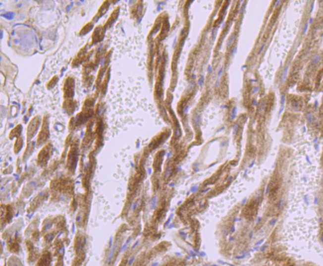 Immunohistochemical analysis of paraffin-embedded mouse heart tissue using anti-Dysferlin antibody. The section was pre-treated using heat mediated antigen retrieval with Tris-EDTA buffer (pH 8.0-8.4) for 20 minutes.The tissues were blocked in 5% BSA for 30 minutes at room temperature, washed with ddH2O and PBS, and then probed with the primary antibody (ET1702-45, 1/50) for 30 minutes at room temperature. The detection was performed using an HRP conjugated compact polymer system. DAB was used as the chromogen. Tissues were counterstained with hematoxylin and mounted with DPX.