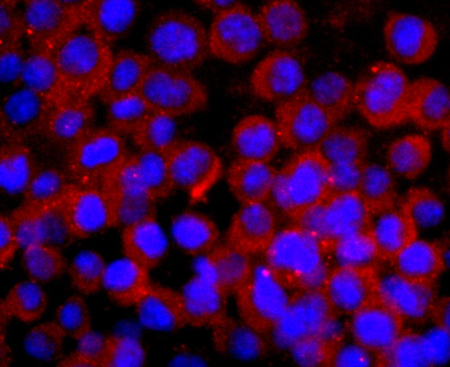 ICC staining of CNPase in N2A cells (red). Formalin fixed cells were permeabilized with 0.1% Triton X-100 in TBS for 10 minutes at room temperature and blocked with 1% Blocker BSA for 15 minutes at room temperature. Cells were probed with the primary antibody (ET1702-46, 1/50) for 1 hour at room temperature, washed with PBS. Alexa Fluor®594 Goat anti-Rabbit IgG was used as the secondary antibody at 1/1,000 dilution. The nuclear counter stain is DAPI (blue).