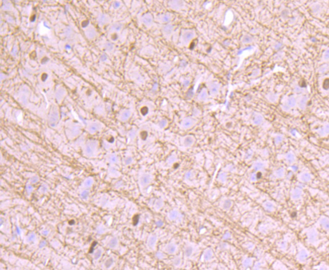 Immunohistochemical analysis of paraffin-embedded mouse brain tissue using anti-CNPase antibody. The section was pre-treated using heat mediated antigen retrieval with Tris-EDTA buffer (pH 8.0-8.4) for 20 minutes.The tissues were blocked in 5% BSA for 30 minutes at room temperature, washed with ddH2O and PBS, and then probed with the primary antibody (ET1702-46, 1/50) for 30 minutes at room temperature. The detection was performed using an HRP conjugated compact polymer system. DAB was used as the chromogen. Tissues were counterstained with hematoxylin and mounted with DPX.