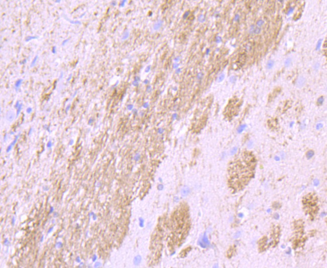 Immunohistochemical analysis of paraffin-embedded rat brain tissue using anti-CNPase antibody. The section was pre-treated using heat mediated antigen retrieval with Tris-EDTA buffer (pH 8.0-8.4) for 20 minutes.The tissues were blocked in 5% BSA for 30 minutes at room temperature, washed with ddH2O and PBS, and then probed with the primary antibody (ET1702-46, 1/50) for 30 minutes at room temperature. The detection was performed using an HRP conjugated compact polymer system. DAB was used as the chromogen. Tissues were counterstained with hematoxylin and mounted with DPX.
