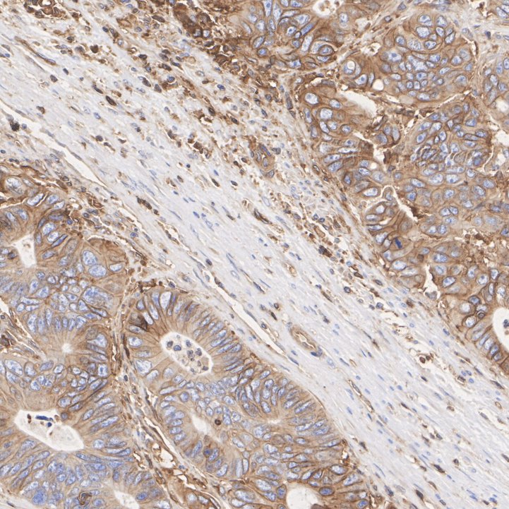 Immunohistochemical analysis of paraffin-embedded human spleen tissue using anti-MHC class I antibody. The section was pre-treated using heat mediated antigen retrieval with Tris-EDTA buffer (pH 9.0) for 20 minutes.The tissues were blocked in 5% BSA for 30 minutes at room temperature, washed with ddH2O and PBS, and then probed with the primary antibody (ET1702-47, 1/50) for 30 minutes at room temperature. The detection was performed using an HRP conjugated compact polymer system. DAB was used as the chromogen. Tissues were counterstained with hematoxylin and mounted with DPX.