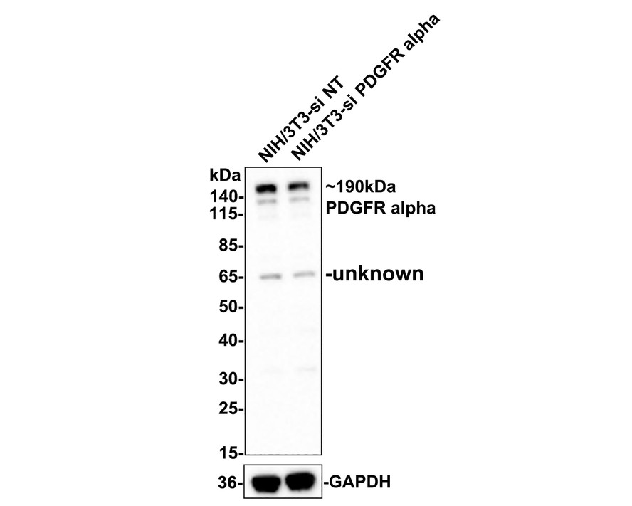 Western blot analysis of PDGFR alpha on different lysates with Rabbit anti-PDGFR alpha antibody (ET1702-49) at 1/500 dilution.<br />
<br />
Lane 1: NIH/3T3-si NT cell lysate<br />
Lane 2: NIH/3T3-si PDGFR alpha cell lysate<br />
<br />
Lysates/proteins at 10 µg/Lane.<br />
<br />
Predicted band size: 123 kDa<br />
Observed band size: 190 kDa<br />
<br />
Exposure time: 2 minutes;<br />
<br />
4-20% SDS-PAGE gel.<br />
<br />
ET1702-49 was shown to specifically react with PDGFR alpha in Hela-si NT cells. Weakened band was observed when Hela-si PDGFR alpha sample was tested. Hela-si NT and Hela-si PDGFR alpha samples were subjected to SDS-PAGE. Proteins were transferred to a PVDF membrane and blocked with 5% NFDM in TBST for 1 hour at room temperature. The primary antibody (ET1702-49, 1/500) and Loading control antibody (Rabbit anti-GAPDH, ET1601-4, 1/10,000) were used in 5% BSA at room temperature for 2 hours. Goat Anti-rabbit IgG-HRP Secondary Antibody (HA1001) at 1:300,000 dilution was used for 1 hour at room temperature.