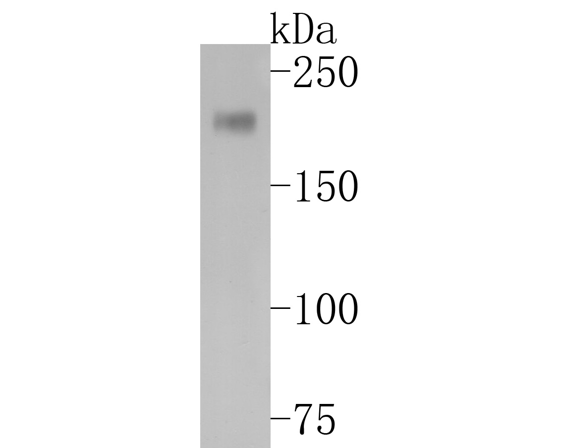 Western blot analysis of PDGFR alpha on SHG-44 cell lysates. Proteins were transferred to a PVDF membrane and blocked with 5% BSA in PBS for 1 hour at room temperature. The primary antibody (ET1702-49, 1/500) was used in 5% BSA at room temperature for 2 hours. Goat Anti-Rabbit IgG - HRP Secondary Antibody (HA1001) at 1:5,000 dilution was used for 1 hour at room temperature.