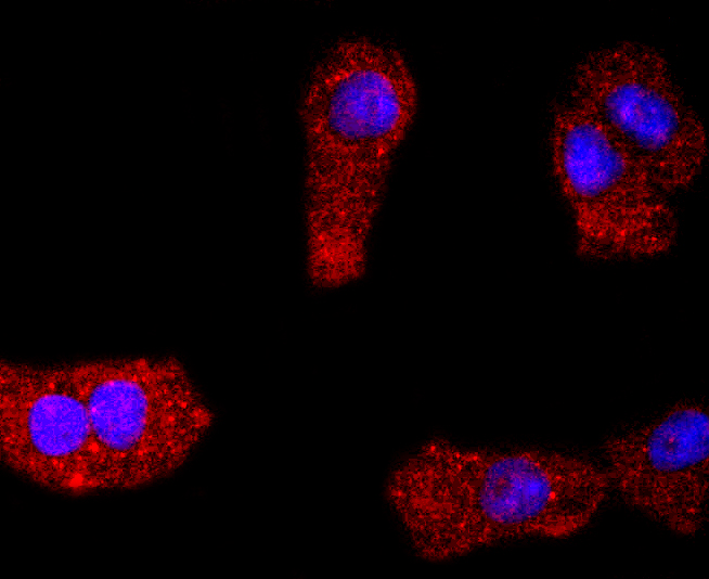 ICC staining of PDGFR alpha in NIH/3T3 cells (red). Formalin fixed cells were permeabilized with 0.1% Triton X-100 in TBS for 10 minutes at room temperature and blocked with 1% Blocker BSA for 15 minutes at room temperature. Cells were probed with the primary antibody (ET1702-49, 1/50) for 1 hour at room temperature, washed with PBS. Alexa Fluor®594 Goat anti-Rabbit IgG was used as the secondary antibody at 1/1,000 dilution. The nuclear counter stain is DAPI (blue).