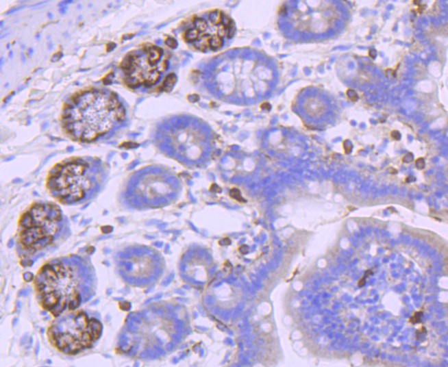 Immunohistochemical analysis of paraffin-embedded mouse brain tissue using anti-PDGFR alpha antibody. The section was pre-treated using heat mediated antigen retrieval with Tris-EDTA buffer (pH 8.0-8.4) for 20 minutes.The tissues were blocked in 5% BSA for 30 minutes at room temperature, washed with ddH2O and PBS, and then probed with the primary antibody (ET1702-49, 1/50) for 30 minutes at room temperature. The detection was performed using an HRP conjugated compact polymer system. DAB was used as the chromogen. Tissues were counterstained with hematoxylin and mounted with DPX.