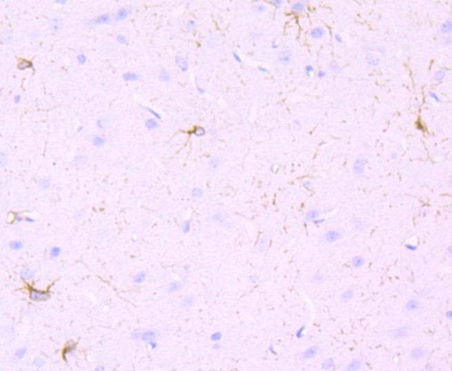 Immunohistochemical analysis of paraffin-embedded mouse brain tissue using anti-PDGFR alpha antibody. The section was pre-treated using heat mediated antigen retrieval with Tris-EDTA buffer (pH 8.0-8.4) for 20 minutes.The tissues were blocked in 5% BSA for 30 minutes at room temperature, washed with ddH2O and PBS, and then probed with the primary antibody (ET1702-49, 1/50) for 30 minutes at room temperature. The detection was performed using an HRP conjugated compact polymer system. DAB was used as the chromogen. Tissues were counterstained with hematoxylin and mounted with DPX.