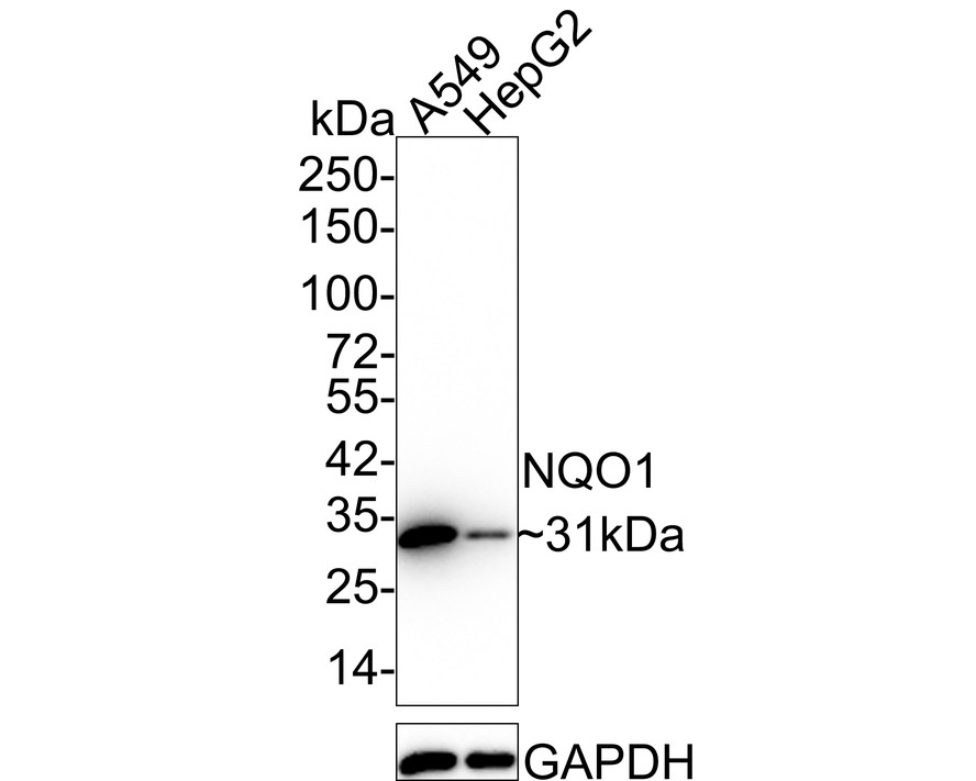 Western blot analysis of NQO1 on different lysates. Proteins were transferred to a PVDF membrane and blocked with 5% BSA in PBS for 1 hour at room temperature. The primary antibody (ET1702-50, 1/500) was used in 5% BSA at room temperature for 2 hours. Goat Anti-Rabbit IgG - HRP Secondary Antibody (HA1001) at 1:5,000 dilution was used for 1 hour at room temperature.<br />
Positive control: <br />
Lane 1: mouse kidney tissue lysate<br />
Lane 2: SH-SY5Y cell lysate