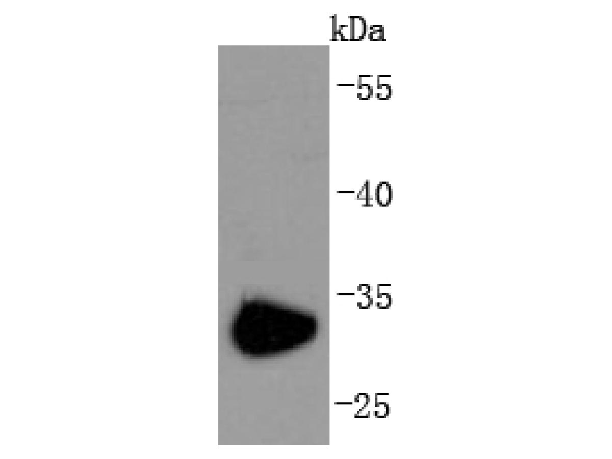 Western blot analysis of CD74 on Raji cells lysates using anti-CD74 antibody at 1/1,000 dilution.