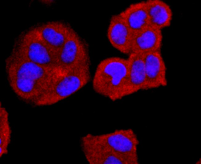 ICC staining CD74 in Hela cells (red). The nuclear counter stain is DAPI (blue). Cells were fixed in paraformaldehyde, permeabilised with 0.25% Triton X100/PBS.