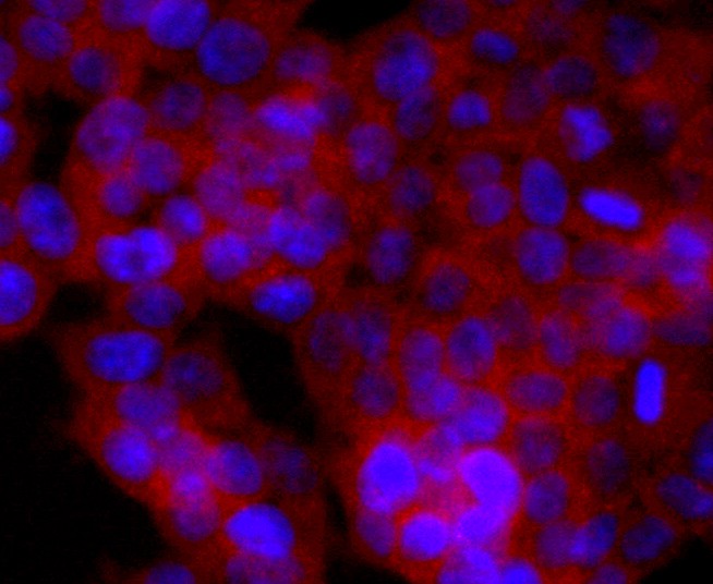 ICC staining CD74 in 293T cells (red). The nuclear counter stain is DAPI (blue). Cells were fixed in paraformaldehyde, permeabilised with 0.25% Triton X100/PBS.