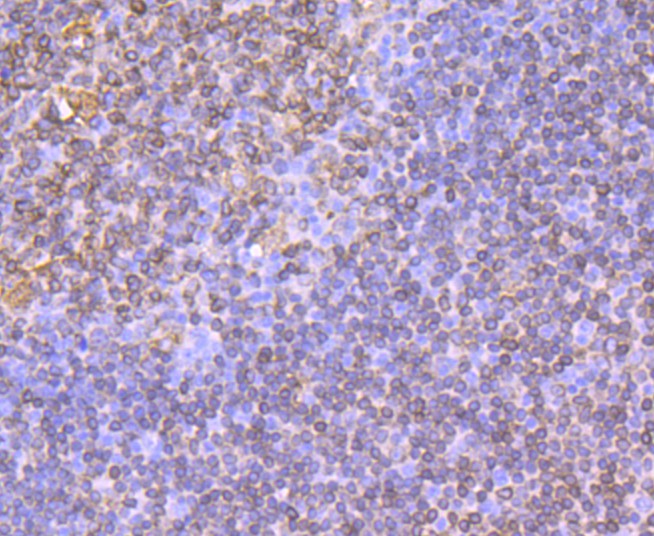 Immunohistochemical analysis of paraffin-embedded human tonsil tissue using anti-CD74 antibody. Counter stained with hematoxylin.
