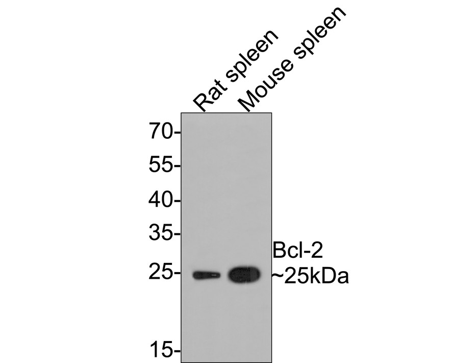 Western blot analysis of Bcl-2 on different lysates with Rabbit anti-Bcl-2 antibody (ET1702-53) at 1/500 dilution.<br />
<br />
Lane 1: HL-60 cell lysate<br />
Lane 2: THP-1 cell lysate<br />
Lane 3: Jurkat cell lysate<br />
<br />
Lysates/proteins at 10 µg/Lane.<br />
<br />
Predicted band size: 26 kDa<br />
Observed band size: 25 kDa<br />
<br />
Exposure time: 2 minutes;<br />
<br />
15% SDS-PAGE gel.<br />
<br />
Proteins were transferred to a PVDF membrane and blocked with 5% NFDM/TBST for 1 hour at room temperature. The primary antibody (ET1702-53) at 1/500 dilution was used in 5% NFDM/TBST at room temperature for 2 hours. Goat Anti-Rabbit IgG - HRP Secondary Antibody (HA1001) at 1:300,000 dilution was used for 1 hour at room temperature.