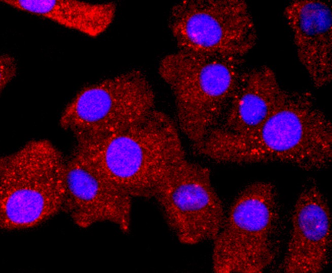 ICC staining of Bcl-2 in A549 cells (red). Formalin fixed cells were permeabilized with 0.1% Triton X-100 in TBS for 10 minutes at room temperature and blocked with 1% Blocker BSA for 15 minutes at room temperature. Cells were probed with the primary antibody (ET1702-53, 1/50) for 1 hour at room temperature, washed with PBS. Alexa Fluor®594 Goat anti-Rabbit IgG was used as the secondary antibody at 1/1,000 dilution. The nuclear counter stain is DAPI (blue).